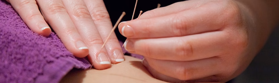 Acupuncture et médecines douces